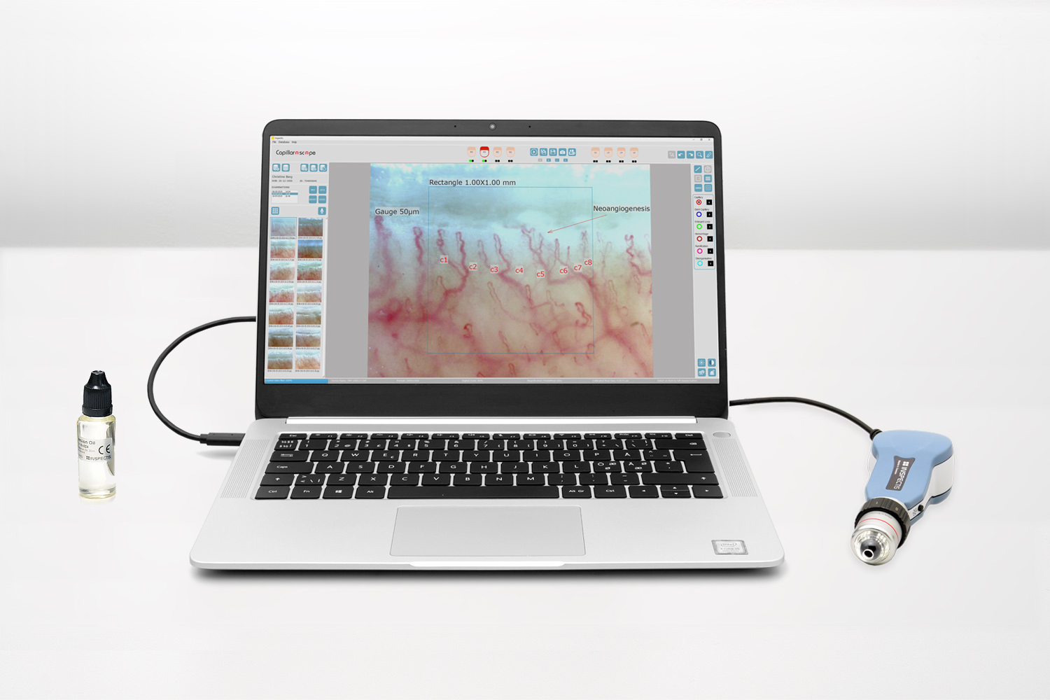 Video Capillaroscope Professional