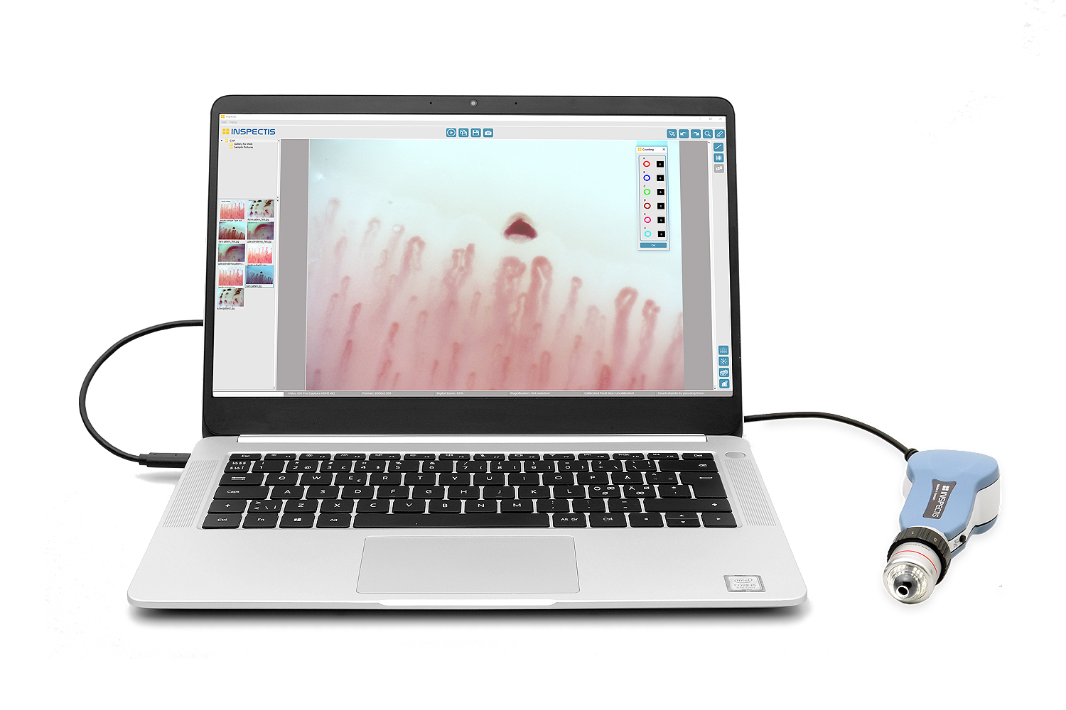 Digital Capillaoscope