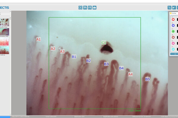 Video Capillaroscopy software